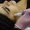 SkinPen Microneedling1